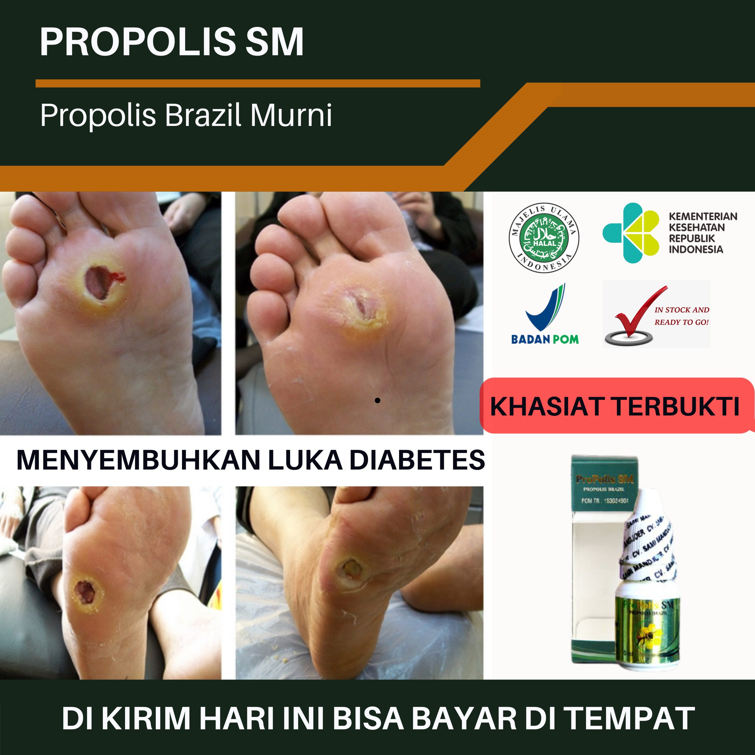 Mimpi Telapak Kaki Luka: Makna, Interpretasi, dan Cara Mengatasinya